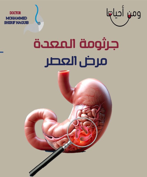 علاج جرثومة المعدة 