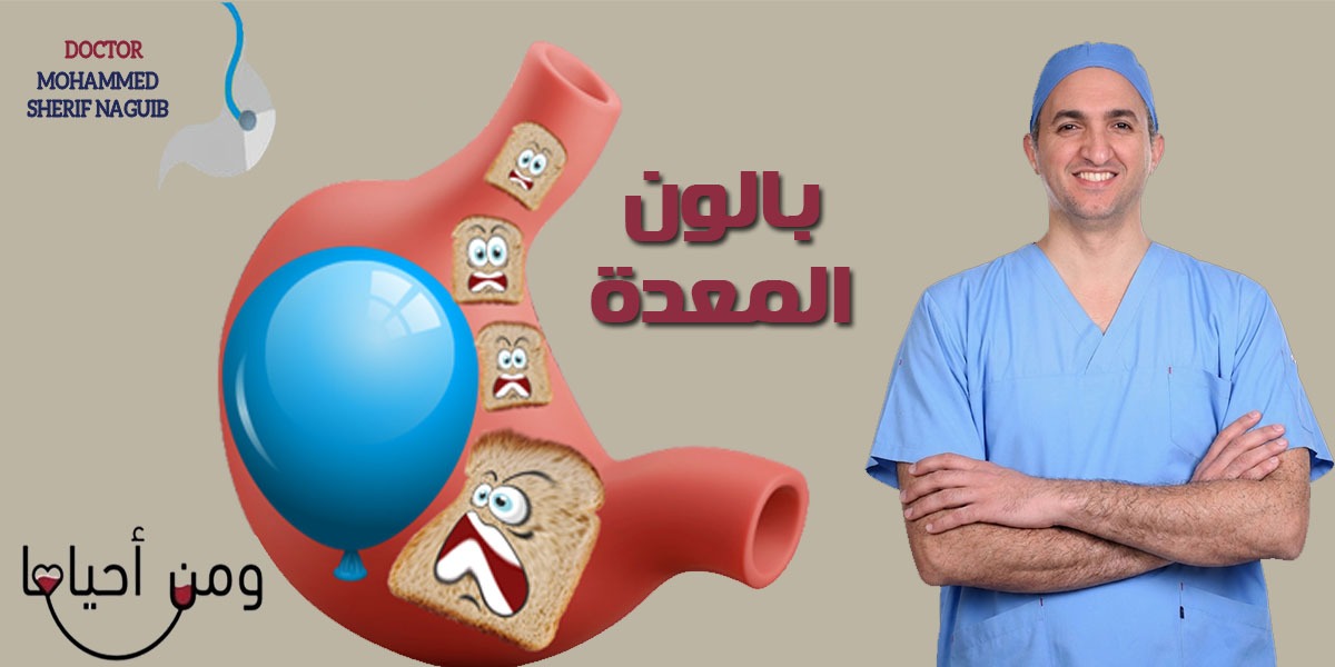 بالون المعدة..
